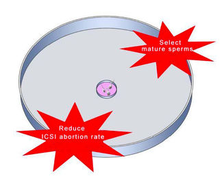 O prato da seleção do esperma do ácido hialurónico para ICSI IVF reduz a taxa da perda da gravidez