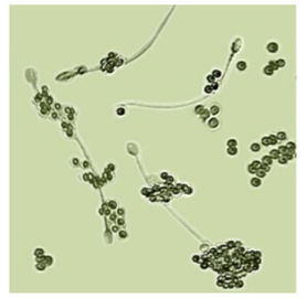 Jogo masculino do teste da fertilidade BRED-011 para o diagnóstico masculino da infertilidade dos espermatozoides da determinação
