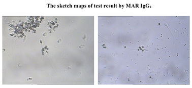 Jogo masculino do teste da fertilidade de SpermFunc para espermatozoides do revestimento do anticorpo de IgG da determinação