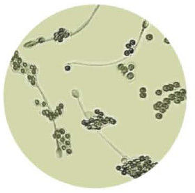 Anti jogo MARÇO AsAb do teste de IgG do anticorpo do esperma para a infertilidade imunológica