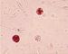 Simple Operate Men'S Fertility Test Kit POX - Semen Leukocytes Test Kit Peroxidase Staining
