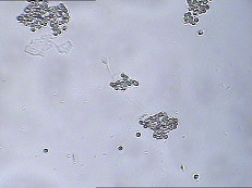 Jogo do teste de função do esperma de MARÇO IgA Test Kit IgA Antibody Coating Spermatozoa MARÇO