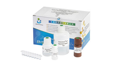 Nível masculino de Kit For Determination Acid Phosphatase do teste da fertilidade BRED-009 no plasma seminal