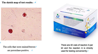 Kit de teste de leucócitos de amostra de sêmen 40T/kit para triagem de infecção do trato reprodutivo masculino