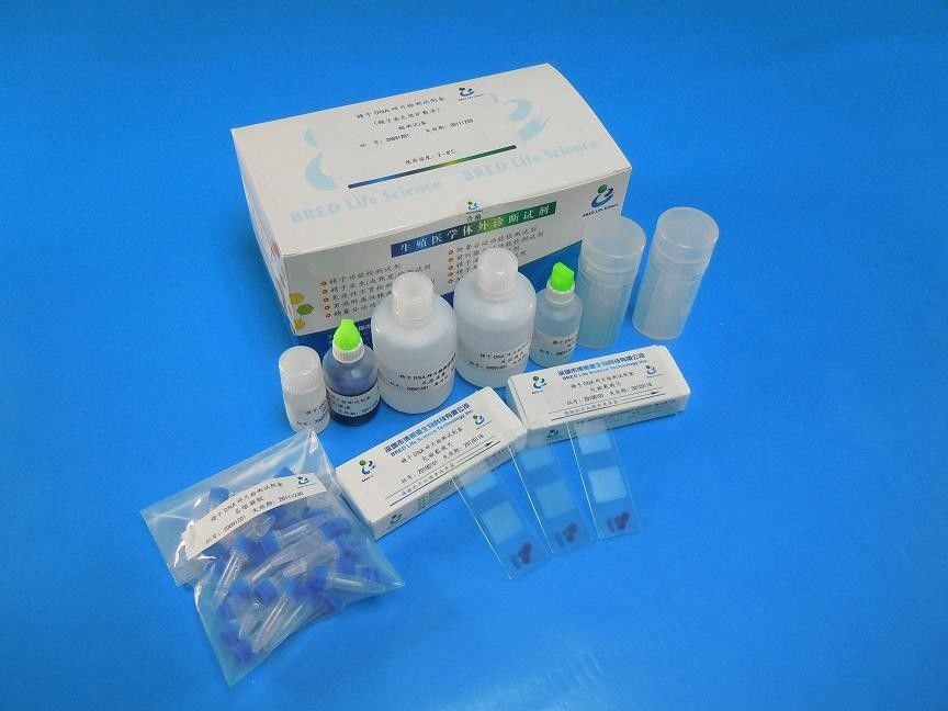 Kit de teste de fragmentação de DNA de espermatozóides Wright com método SCD para 40 testes/Kit em laboratórios de andrologia